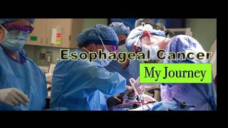 Esophageal Cancer My Journey 2 [upl. by Thaxter]