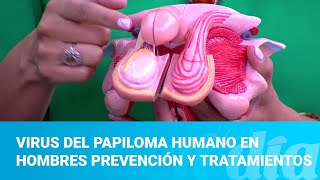 Virus del papiloma humano en hombres prevención y tratamientos [upl. by Ecnerewal]