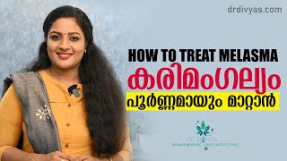 കരിമംഗല്യം പൂർണ്ണമായും മാറ്റാൻ  How To Treat MELASMA  Dark Spots  HYPER PIGMENTATION On Face [upl. by Pizor794]