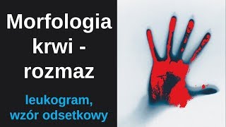 Morfologia krwi  rozmaz automatyczny lub ręczny  leukogram [upl. by Lennor]