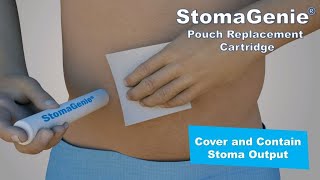 StomaGenie cartridge covers and contains stoma output during ostomy pouch changes [upl. by Eiramanna]