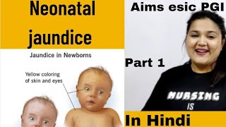 part 1 Neonatal jaundice icterus neonatorum neonatal hyperbilirubinemia  types Hindi [upl. by Adlee534]