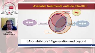 Allogeneic Stem Cell Transplantation for Myelofibrosis [upl. by Faucher156]