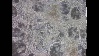 Heart Cells derived from iPSC Stem Cells beat in Culture Dish [upl. by Stalker405]