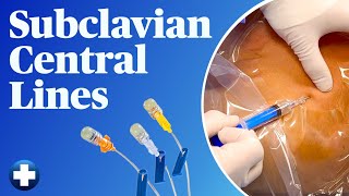 Subclavian Central Lines Easy and Safe Landmark Method [upl. by Ffirahs706]