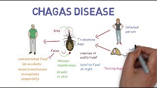 Chagas Disease  An overview [upl. by Lebiram]