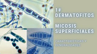 Micosis superficiales  1  Dermatofitos  Trichophyton  Epidermophyton  Microsporum [upl. by Atiral]