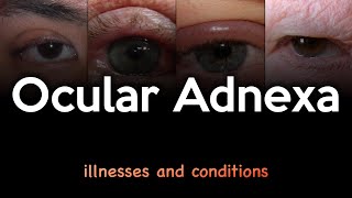 Ocular Adnexa Illnesses and Conditions [upl. by Ynnub]