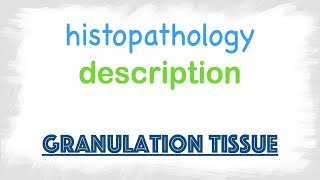 Granulation Tissue  Histopathology [upl. by Iccir]