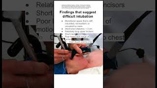 Findings that suggest difficult intubation [upl. by Cirded]