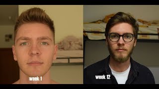 Patchy blonde beard Time Lapse  3 Months [upl. by Ffej]