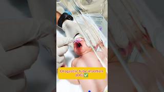 Orogastric tube insertion Nursing process hospital nursing medical trending ytshorts youtube [upl. by Stanhope]