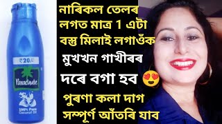 নাৰিকল তেলৰ লগত মাত্ৰ1বস্তু মিলাই লগাওঁক মুখখন গাখীৰৰ দৰে বগা কৰিকলা দাগবয়সৰ ৰেখা আঁতৰাবছালৰ যত্ন [upl. by Honig]