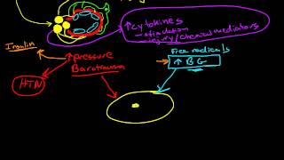 Pathophysiology of Diabetic Nephropathy [upl. by Bronk]