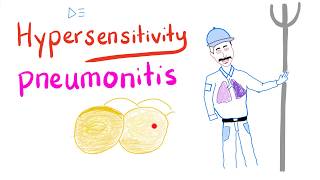 Hypersensitivity Pneumonitis  Restrictive Lung Diseases  Pulmonology [upl. by Upali]