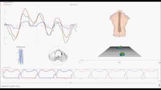 DIERS 4Dmotion®  Kombinierte Ansicht formetricpedogait [upl. by Yrem]