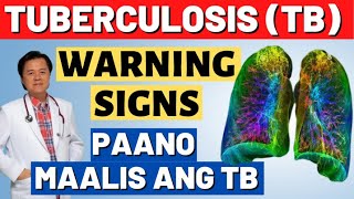 Tuberculosis TB Warnings Signs Paano Maalis ang TB  By Doc Willie Ong [upl. by Sousa]