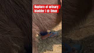 Rupture of urinary bladder l Retention of urinary bladder l dr Umar khan [upl. by Ydnab]