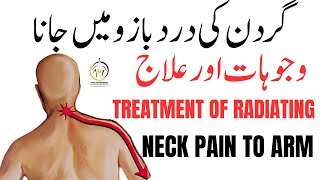 Neck Pain and Arm Numbness Exercises  Radiating Neck Pain in Urdu  Cervical Radiculopathy [upl. by Solange85]