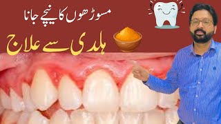 How to use TURMERIC to Cure Gum Recession Gingivitis and Bleeding Gums [upl. by Yelda]