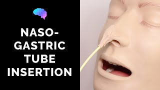 Nasogastric NG Tube Insertion  OSCE Guide  UKMLA  CPSA [upl. by Acireit764]