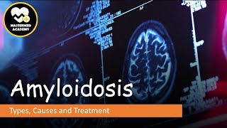 Amyloidosis Types Causes amp Treatment [upl. by Bust171]