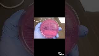 Escherichia coli E coli on MacConkey agar MAC  Clinical Microbiology shorts [upl. by Belier]