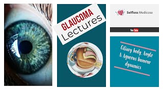 SURGICAL PROCEDURES IN GLAUCOMA made easy part 1 [upl. by Kowtko]