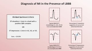 Intro to EKG Interpretation  Myocardial Infarctions Part 2 of 2 [upl. by Noled]