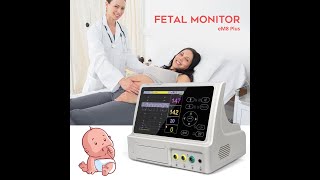 YJFM24A Fetal Monitor Compact Lightweight with BuiltIn Printer [upl. by Wandis573]