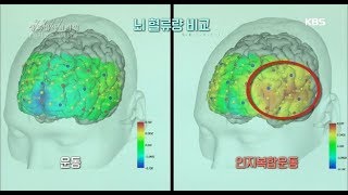 생로병사의 비밀  젊은 뇌를 만드는 방법  운동과 인지훈련20180606 [upl. by Reinhart64]