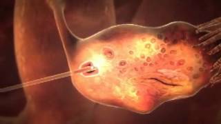 3D animation of how IVF works YouTube [upl. by Flo]