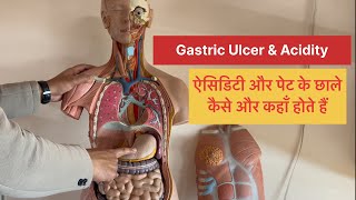 Full Video➡️Gastric Ulcer amp Acidity in Stomach कैसे और कहाँ होता है DigestiveSystem viral trending [upl. by Nihahs926]