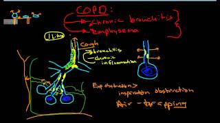 Pathophysiology of COPD [upl. by Letney948]