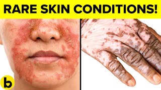 9 DESTRUCTIVE Skin DISEASES And Why You WILL Get Them [upl. by Nameloc638]