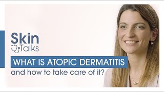 Dr Zocca explains atopic dermatitis causes symptoms advice  Skin Talks 3  BIODERMA [upl. by Linnie]