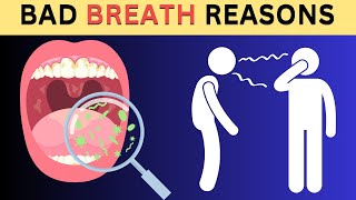 STOP Ignoring These 7 Key Reasons for Bad Breath [upl. by Hanah]