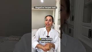 Herpes Test False Positive [upl. by Briney]