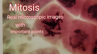 Mitosis  Real microscope image cell division with important points [upl. by Kohl451]