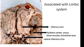 Limbic System  CNS  Neuro ANATOMY [upl. by Glyn]