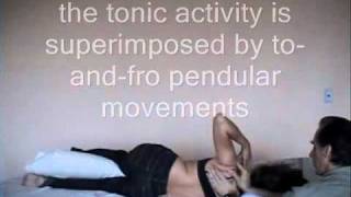 HAND SHOULDER and TRUNK SPONTANEOUS MOVEMENTS DURING MUSCLE REPOSITIONwmv [upl. by Elton]