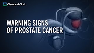 10 Warning Signs of Prostate Cancer [upl. by Weldon770]