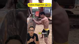 Calos Gigantes 😱👊 curiosidades medico medicina enfermagem enfermeira saude saúde treino [upl. by Octave23]