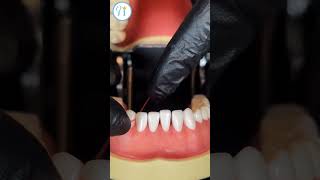 How to floss properly flossing oralhygienetips klinikedentare [upl. by Alyosha]