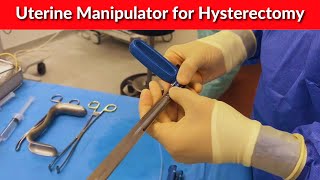 Uterine Manipulator for Hysterectomy  Dr Kunal Rathod [upl. by Krenn]