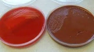 Blood agar 🆚 Chocolate agar preparation تحضير اجار الدم الميكروبيولوجيست [upl. by Hamann]