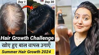 Summer Extreme Hair Growth Challenge  बालों को GROW करने का BEST DIY TONER जो कोई नहीं बताएगा❤️ [upl. by Shayn]