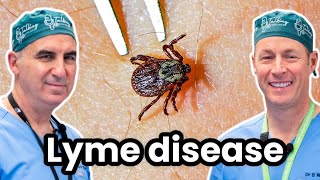 Lyme Disease and Ticks  Causes Treatments and More [upl. by Clarie884]