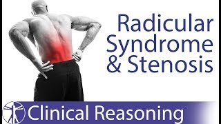 Lumbar Radicular Syndrome vs Intermittent Neurogenic ClaudicationStenosis [upl. by Nya]