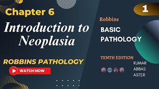 Introduction to Neoplasia  Neoplasia Lectures Chapter 6 Robbins Basic Pathology Lecture 1 [upl. by Alyahsat861]